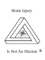 San Diego Brain Injury Lawyer David L Goldin