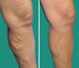 Before and After