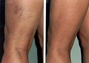 Before and After