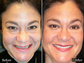 Before and After