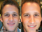 Before and After