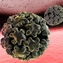 Illustration of the HPV